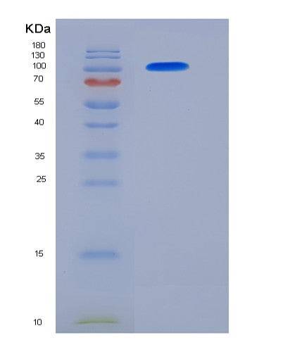SDS-PAGE analysis of Human ACE2 (Angiotensin-Converting Enzyme 2) - Recombinant Protein, showing >85% purity under 15% SDS-PAGE (Reduced)