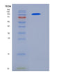 SDS-PAGE analysis of Human ACE2 (Angiotensin-Converting Enzyme 2) - Recombinant Protein, showing >85% purity under 15% SDS-PAGE (Reduced)