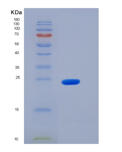 SDS-PAGE analysis of Mouse Jam2 (Junctional Adhesion Molecule B) - Recombinant Protein, showing >95% purity under 15% SDS-PAGE (Reduced)