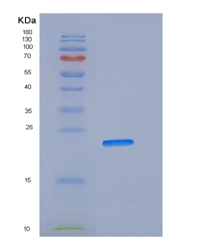 SDS-PAGE analysis of Human SOD2 (Superoxide Dismutase [Mn], Mitochondrial) - Recombinant Protein, showing >90% purity under 15% SDS-PAGE (Reduced)