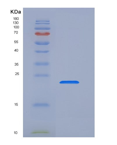 SDS-PAGE analysis of Human TFPI2 (Tissue Factor Pathway Inhibitor 2) - Recombinant Protein, showing >95% purity under 15% SDS-PAGE (Reduced)