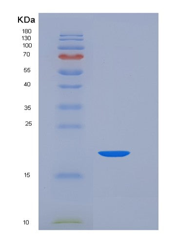 SDS-PAGE analysis of Human CD7 (T-Cell Antigen Cd7) - Recombinant Protein, showing >85% purity under 15% SDS-PAGE (Reduced)