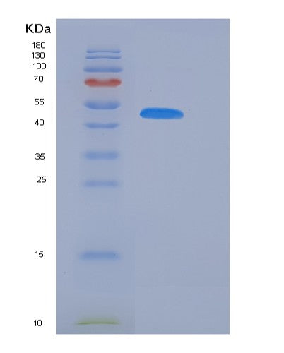 SDS-PAGE analysis of Mouse Serpina11 (Serpin A11) - Recombinant Protein, showing >85% purity under 15% SDS-PAGE (Reduced)