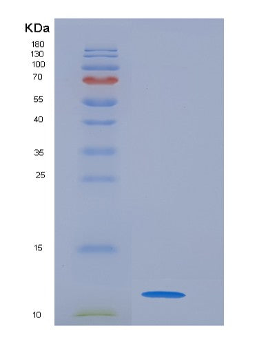 SDS-PAGE analysis of Mouse S100a5 (Protein S100-A5) - Recombinant Protein, showing >95% purity under 15% SDS-PAGE (Reduced)