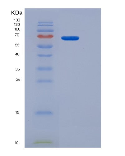 SDS-PAGE analysis of Human ADGRE5 (Adhesion G Protein-Coupled Receptor E5) - Recombinant Protein, showing >95% purity under 15% SDS-PAGE (Reduced)