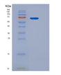 SDS-PAGE analysis of Human ADGRE5 (Adhesion G Protein-Coupled Receptor E5) - Recombinant Protein, showing >95% purity under 15% SDS-PAGE (Reduced)