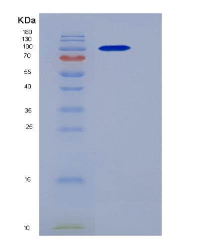SDS-PAGE analysis of Human CTNNB1 (Catenin Beta-1) - Recombinant Protein, showing >90% purity under 15% SDS-PAGE (Reduced)