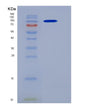 SDS-PAGE analysis of Human CTNNB1 (Catenin Beta-1) - Recombinant Protein, showing >90% purity under 15% SDS-PAGE (Reduced)