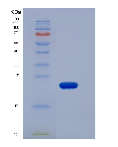 SDS-PAGE analysis of Human CLEC1B (C-Type Lectin Domain Family 1 Member B) - Recombinant Protein, showing >95% purity under 15% SDS-PAGE (Reduced)