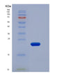 SDS-PAGE analysis of Human CLEC1B (C-Type Lectin Domain Family 1 Member B) - Recombinant Protein, showing >95% purity under 15% SDS-PAGE (Reduced)