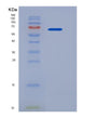 SDS-PAGE analysis of Human SELE (E-Selectin) - Recombinant Protein, showing >90% purity under 15% SDS-PAGE (Reduced)