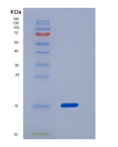 SDS-PAGE analysis of Human FABP5 (Fatty Acid-Binding Protein 5) - Recombinant Protein, showing >85% purity under 15% SDS-PAGE (Reduced)