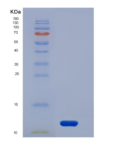 SDS-PAGE analysis of Human ACVRL1 (Activin Receptor Type-1-Like) - Recombinant Protein, showing >95% purity under 15% SDS-PAGE (Reduced)