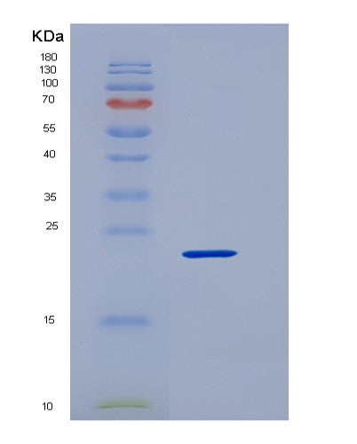 SDS-PAGE analysis of Human MESD (Lrp Chaperone Mesd) - Recombinant Protein, showing >85% purity under 15% SDS-PAGE (Reduced)