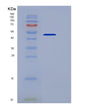 SDS-PAGE analysis of Mouse Thsd1 (Thrombospondin Type-1 Domain-Containing Protein 1) - Recombinant Protein, showing >95% purity under 15% SDS-PAGE (Reduced)