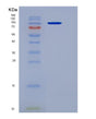 SDS-PAGE analysis of Human DPP4 (Dipeptidyl Peptidase 4) - Recombinant Protein, showing >95% purity under 15% SDS-PAGE (Reduced)