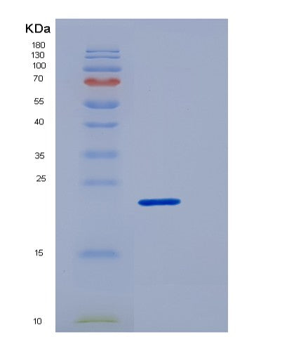 SDS-PAGE analysis of Human TREM1 (Triggering Receptor Expressed On Myeloid Cells 1) - Recombinant Protein, showing >90% purity under 15% SDS-PAGE (Reduced)