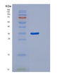 SDS-PAGE analysis of Mouse Ager (Advanced Glycosylation End Product-Specific Receptor) - Recombinant Protein, showing >95% purity under 15% SDS-PAGE (Reduced)