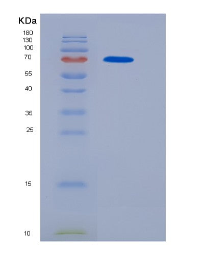 SDS-PAGE analysis of Human OSMR (Oncostatin-M-Specific Receptor Subunit Beta) - Recombinant Protein, showing >95% purity under 15% SDS-PAGE (Reduced)