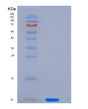 SDS-PAGE analysis of Human CGA (Glycoprotein Hormones Alpha Chain) - Recombinant Protein, showing >95% purity under 15% SDS-PAGE (Reduced)
