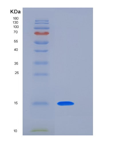 SDS-PAGE analysis of Human LAIR2 (Leukocyte-Associated Immunoglobulin-Like Receptor 2) - Recombinant Protein, showing >95% purity under 15% SDS-PAGE (Reduced)