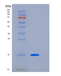SDS-PAGE analysis of Human LAIR2 (Leukocyte-Associated Immunoglobulin-Like Receptor 2) - Recombinant Protein, showing >95% purity under 15% SDS-PAGE (Reduced)