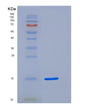 SDS-PAGE analysis of Human FABP3 (Fatty Acid-Binding Protein, Heart) - Recombinant Protein, showing >85% purity under 15% SDS-PAGE (Reduced)