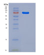 SDS-PAGE analysis of Human NTRK3 (Nt-3 Growth Factor Receptor) - Recombinant Protein, showing >85% purity under 15% SDS-PAGE (Reduced)