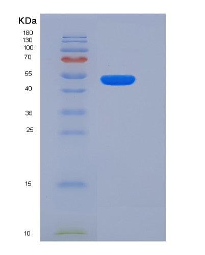 SDS-PAGE analysis of Human CTSC (Dipeptidyl Peptidase 1) - Recombinant Protein, showing >95% purity under 15% SDS-PAGE (Reduced)