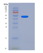 SDS-PAGE analysis of Human CTSC (Dipeptidyl Peptidase 1) - Recombinant Protein, showing >95% purity under 15% SDS-PAGE (Reduced)