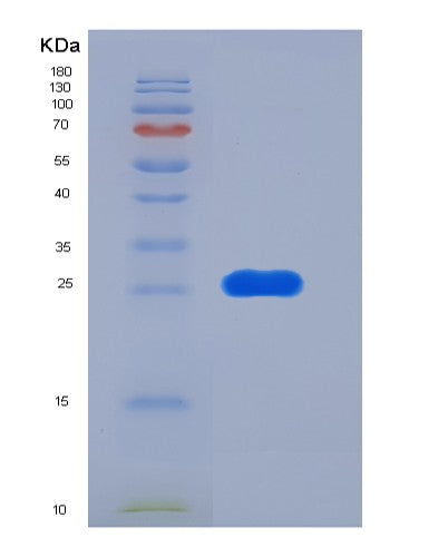 SDS-PAGE analysis of Human FOLR2 (Folate Receptor Beta) - Recombinant Protein, showing >95% purity under 15% SDS-PAGE (Reduced)