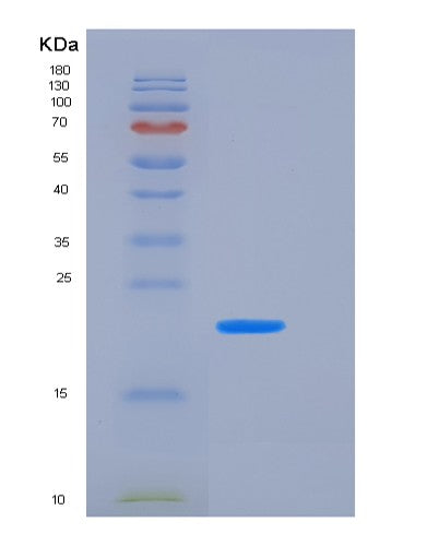 SDS-PAGE analysis of Human TNFRSF4 (Tumor Necrosis Factor Receptor Superfamily Member 4) - Recombinant Protein, showing >90% purity under 15% SDS-PAGE (Reduced)
