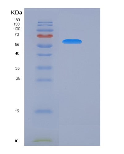 SDS-PAGE analysis of Mouse Ecm1 (Extracellular Matrix Protein 1) - Recombinant Protein, showing >95% purity under 15% SDS-PAGE (Reduced)