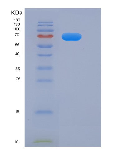 SDS-PAGE analysis of Mouse Egfr (Epidermal Growth Factor Receptor) - Recombinant Protein, showing >85% purity under 15% SDS-PAGE (Reduced)