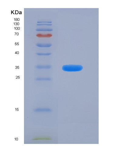 SDS-PAGE analysis of Human CADM3 (Cell Adhesion Molecule 3) - Recombinant Protein, showing >95% purity under 15% SDS-PAGE (Reduced)