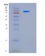 SDS-PAGE analysis of Mouse Egfr (Epidermal Growth Factor Receptor) - Recombinant Protein, showing >95% purity under 15% SDS-PAGE (Reduced)