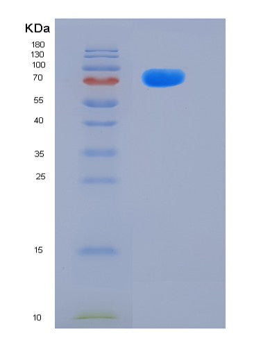 SDS-PAGE analysis of Human MME (Neprilysin) - Recombinant Protein, showing >90% purity under 15% SDS-PAGE (Reduced)