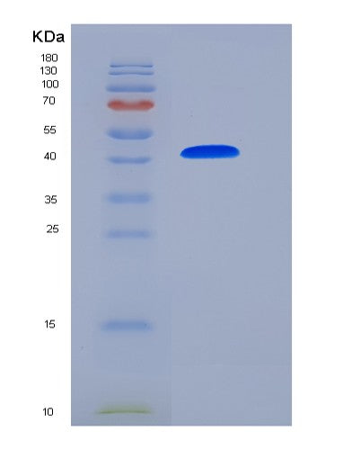 SDS-PAGE analysis of Mouse Serpina3c (Serine Protease Inhibitor A3C) - Recombinant Protein, showing >85% purity under 15% SDS-PAGE (Reduced)
