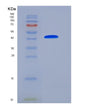SDS-PAGE analysis of Mouse Serpina3c (Serine Protease Inhibitor A3C) - Recombinant Protein, showing >85% purity under 15% SDS-PAGE (Reduced)