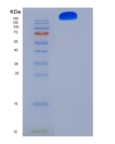 SDS-PAGE analysis of Human ITGA5 (Integrin Alpha-5) - Recombinant Protein, CAT# BLT-08432P showing >95% purity under 15% SDS-PAGE (Reduced)