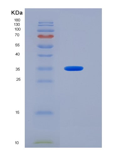 SDS-PAGE analysis of Mouse Nectin2 (Nectin-2) - Recombinant Protein, showing >95% purity under 15% SDS-PAGE (Reduced)