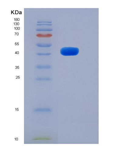 SDS-PAGE analysis of Mouse Robo4 (Roundabout Homolog 4) - Recombinant Protein, showing >85% purity under 15% SDS-PAGE (Reduced)