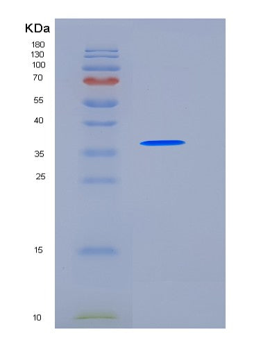 SDS-PAGE analysis of Human CD5L (Cd5 Antigen-Like) - Recombinant Protein, showing >95% purity under 15% SDS-PAGE (Reduced)