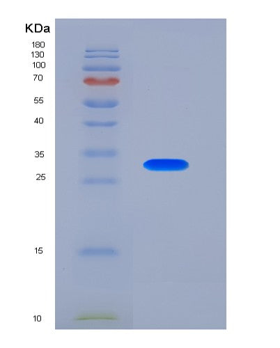 SDS-PAGE analysis of Mouse Tnfrsf13c (Tumor Necrosis Factor Receptor Superfamily Member 13C) - Recombinant Protein, showing >95% purity under 15% SDS-PAGE (Reduced)