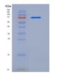 SDS-PAGE analysis of Mouse Erbb4 (Receptor Tyrosine-Protein Kinase Erbb-4) - Recombinant Protein, showing >90% purity under 15% SDS-PAGE (Reduced)