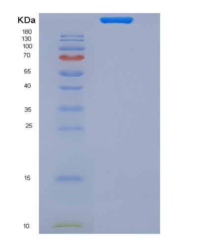 SDS-PAGE analysis of Mouse Btla (B- And T-Lymphocyte Attenuator) - Recombinant Protein, showing >85% purity under 15% SDS-PAGE (Reduced)