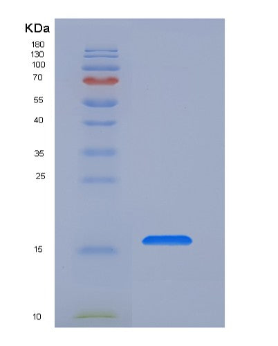 SDS-PAGE analysis of Human FZD4 (Frizzled-4) - Recombinant Protein, showing >95% purity under 15% SDS-PAGE (Reduced)