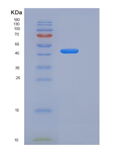SDS-PAGE analysis of Mouse Ace2 (Angiotensin-Converting Enzyme 2) - Recombinant Protein, showing >90% purity under 15% SDS-PAGE (Reduced)