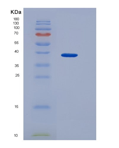 SDS-PAGE analysis of Human THY1 (Thy-1 Membrane Glycoprotein) - Recombinant Protein, showing >90% purity under 15% SDS-PAGE (Reduced)