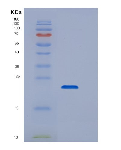SDS-PAGE analysis of Human CD44 (Cd44 Antigen) - Recombinant Protein, showing >85% purity under 15% SDS-PAGE (Reduced)